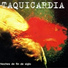 Taquicardia