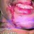 Lil Tracy, Bighead
