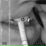 DLAA