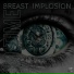 Breast Implosion