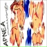 Apnea