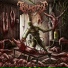 Traumatomy