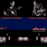 Charlie Hunter, Leon Parker