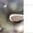 Dallas Acid