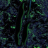 Ogkaraz