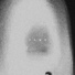 The Acid