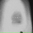 The Acid
