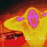 руди
